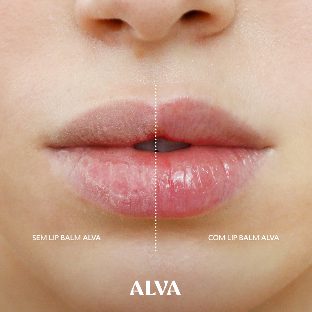 Kit Presente Alva